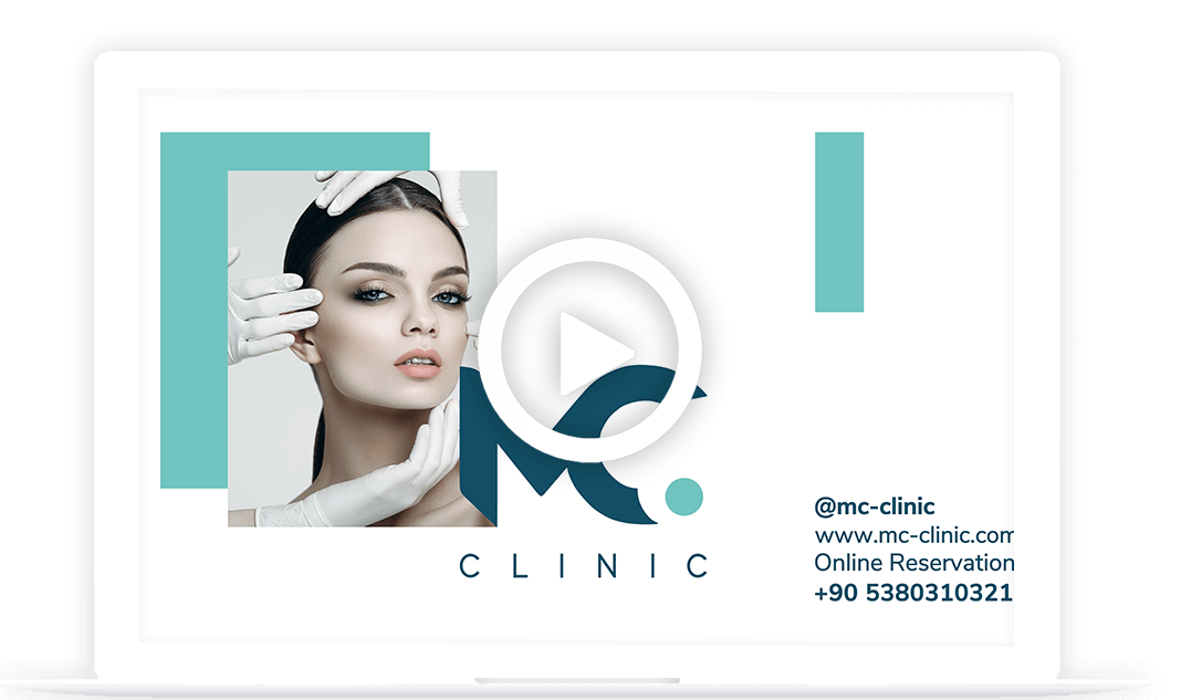 MC VIDEO