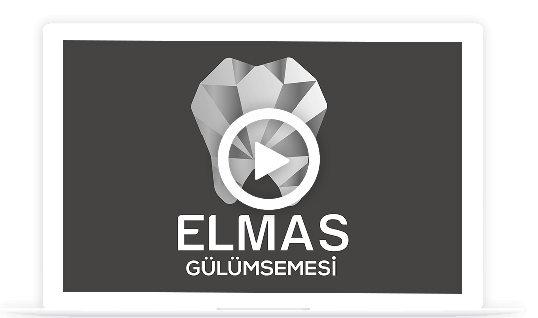 ELMAS VIDEO